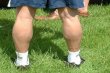 Hot weather always brings out some horrendous sights